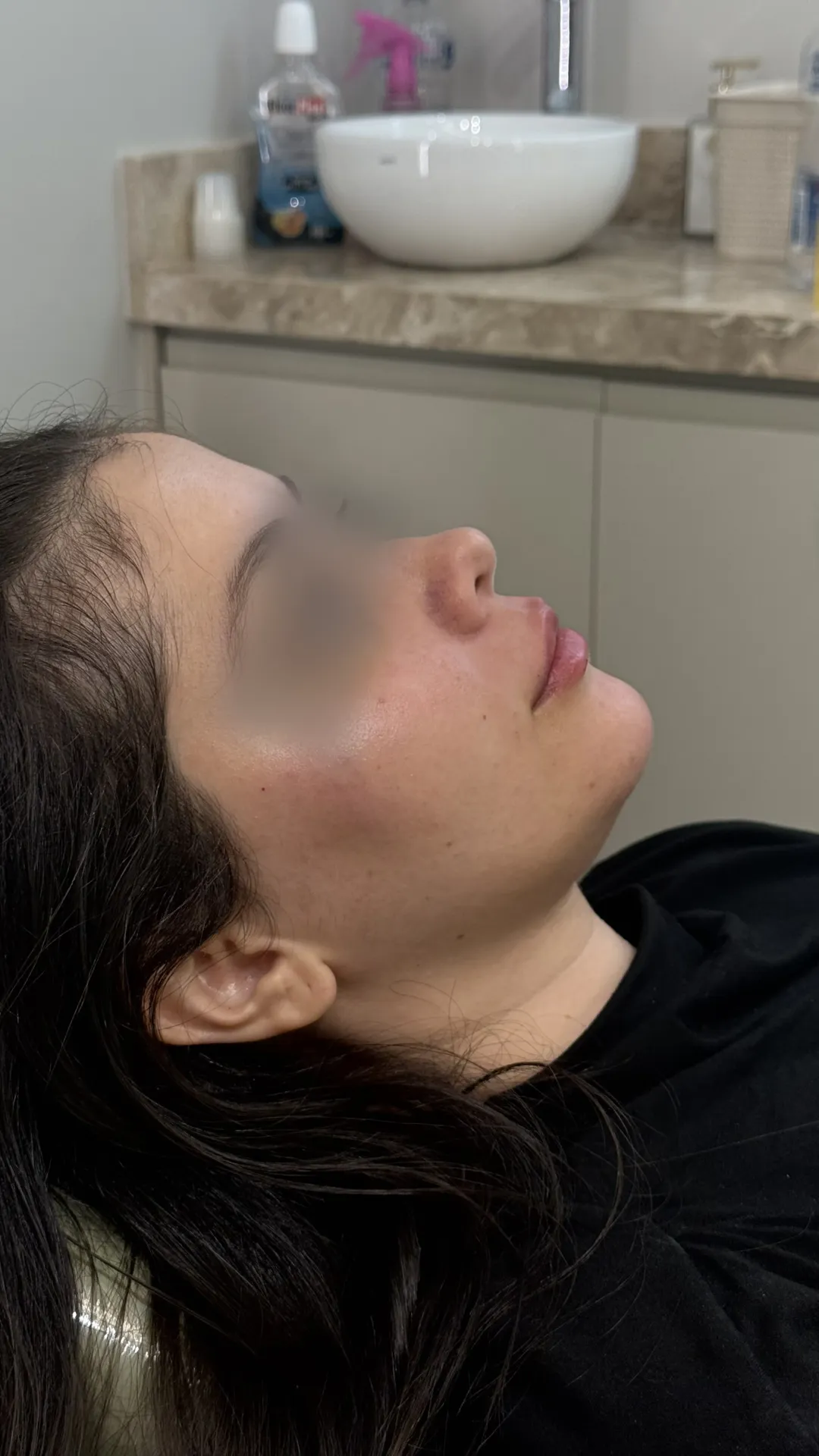 Resultado de tratamento odontológico e estético realizado pela Dra. Júlia Hummel